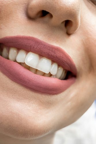 Estética dental